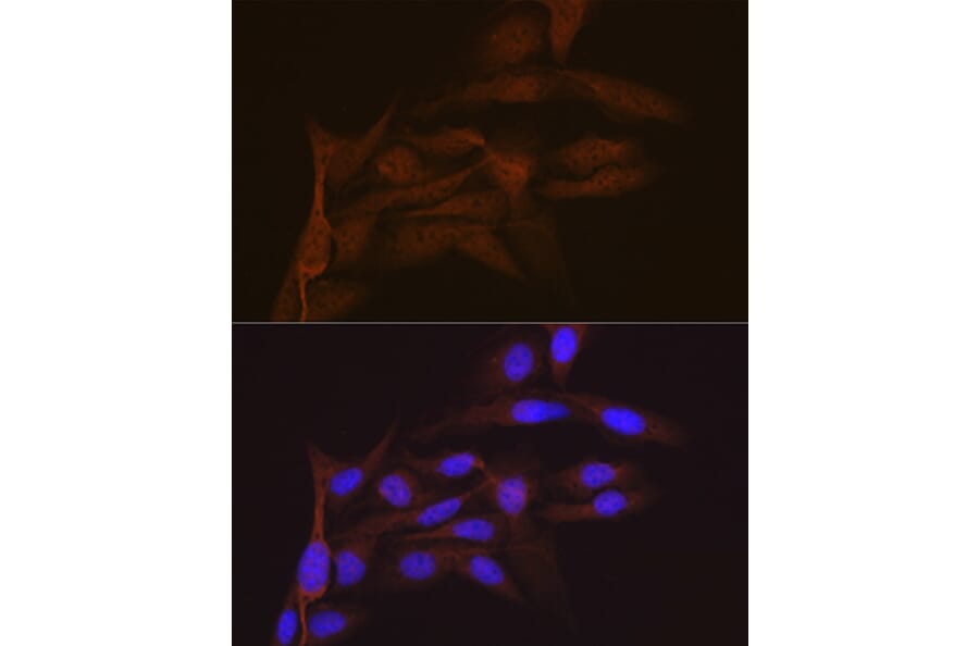 Immunofluorescence - Anti-SMC4 Antibody [ARC2042] (A305900) - Antibodies.com