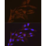 Immunofluorescence - Anti-SMC4 Antibody [ARC2042] (A305900) - Antibodies.com