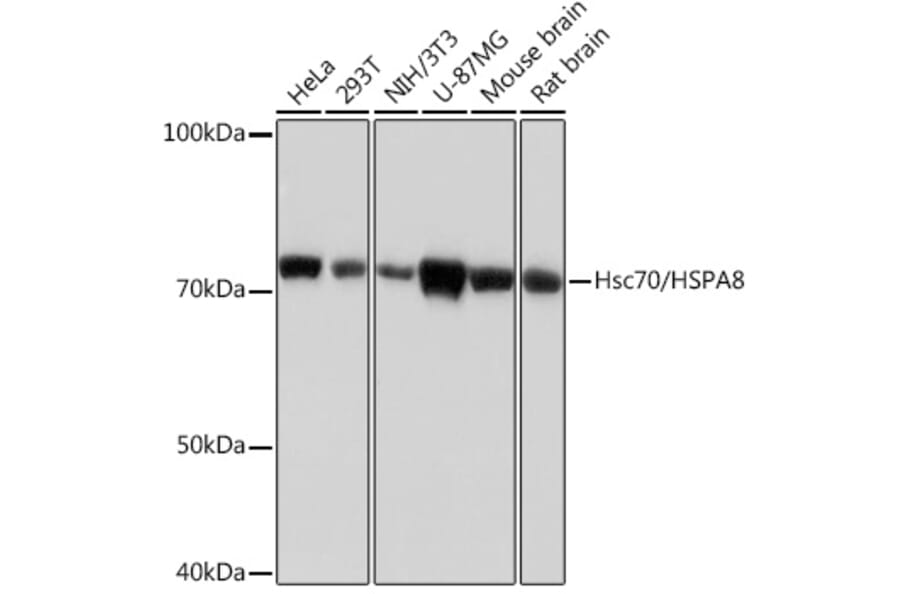 Western Blot - Anti-Hsc70 Antibody [ARC0258] (A305901) - Antibodies.com