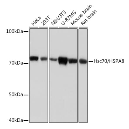 Western Blot - Anti-Hsc70 Antibody [ARC0258] (A305901) - Antibodies.com
