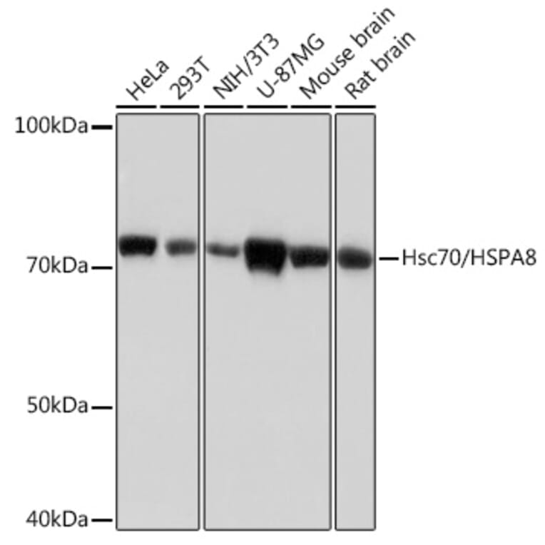 Western Blot - Anti-Hsc70 Antibody [ARC0258] (A305901) - Antibodies.com