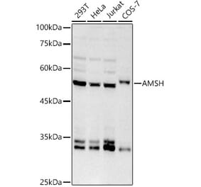 Western Blot - Anti-AMSH Antibody [ARC2840] (A305903) - Antibodies.com