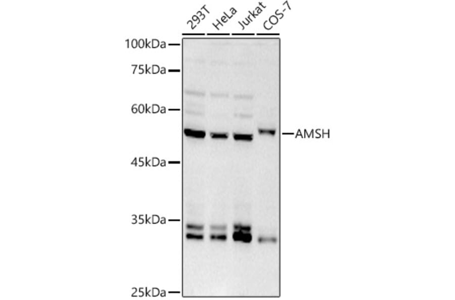 Western Blot - Anti-AMSH Antibody [ARC2840] (A305903) - Antibodies.com