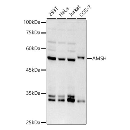 Western Blot - Anti-AMSH Antibody [ARC2840] (A305903) - Antibodies.com