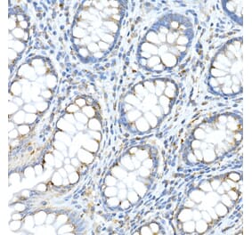 Immunohistochemistry - Anti-Fam3a Antibody (A305905) - Antibodies.com