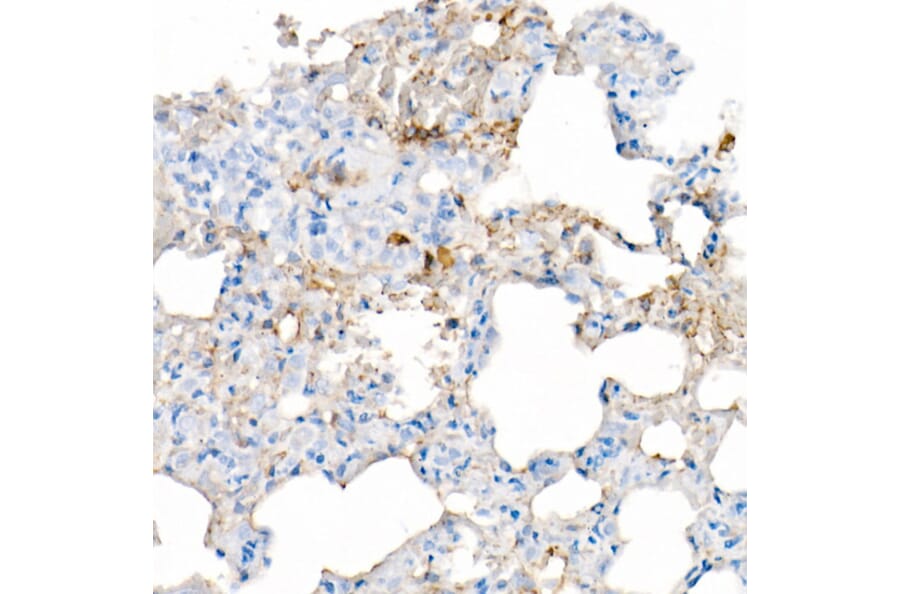 Immunohistochemistry - Anti-IL-6 Antibody [ARC53388] (A305906) - Antibodies.com