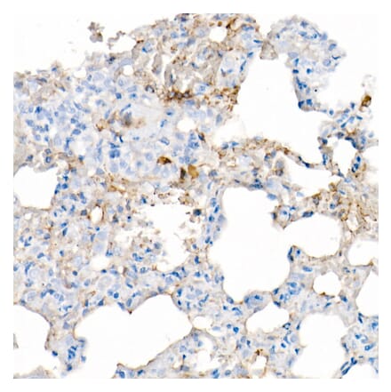 Immunohistochemistry - Anti-IL-6 Antibody [ARC53388] (A305906) - Antibodies.com