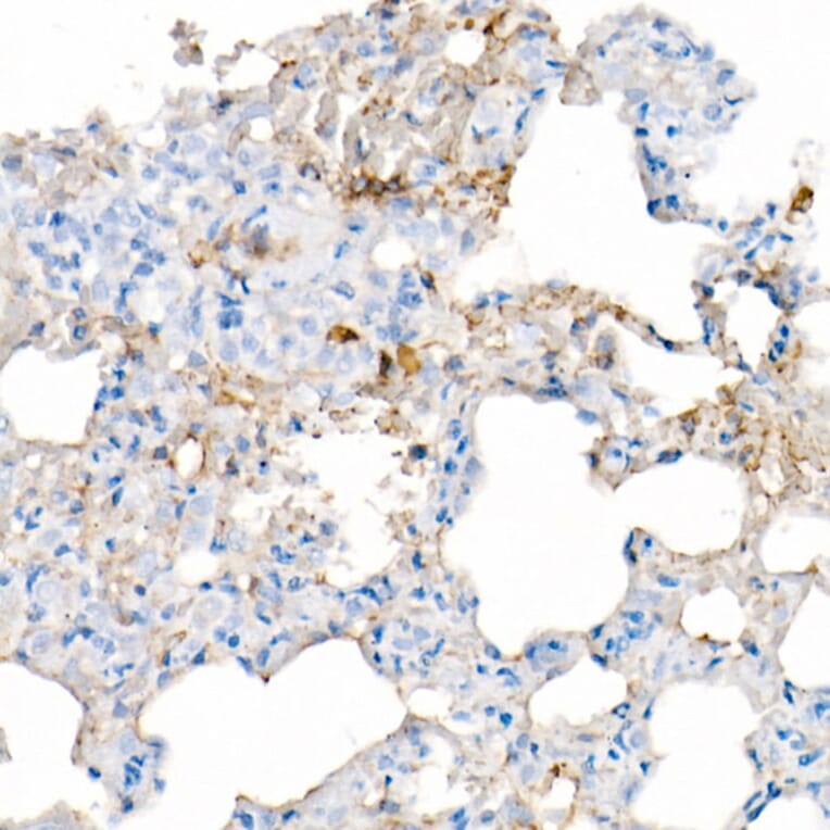 Immunohistochemistry - Anti-IL-6 Antibody [ARC53388] (A305906) - Antibodies.com