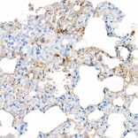 Immunohistochemistry - Anti-IL-6 Antibody [ARC53388] (A305906) - Antibodies.com