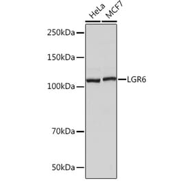 Western Blot - Anti-GPCR LGR6 Antibody [ARC1440] (A305907) - Antibodies.com