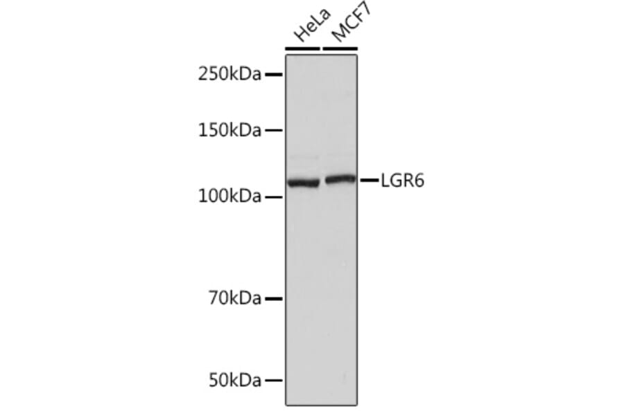 Western Blot - Anti-GPCR LGR6 Antibody [ARC1440] (A305907) - Antibodies.com