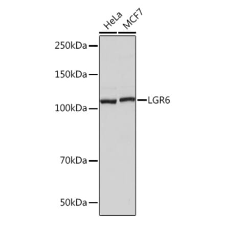 Western Blot - Anti-GPCR LGR6 Antibody [ARC1440] (A305907) - Antibodies.com