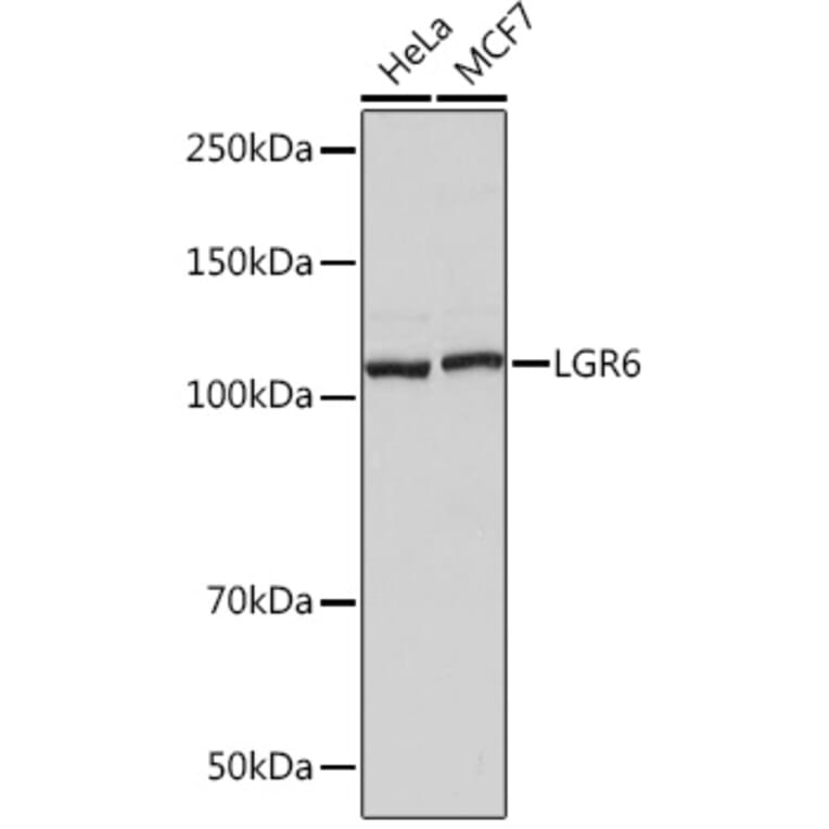 Western Blot - Anti-GPCR LGR6 Antibody [ARC1440] (A305907) - Antibodies.com