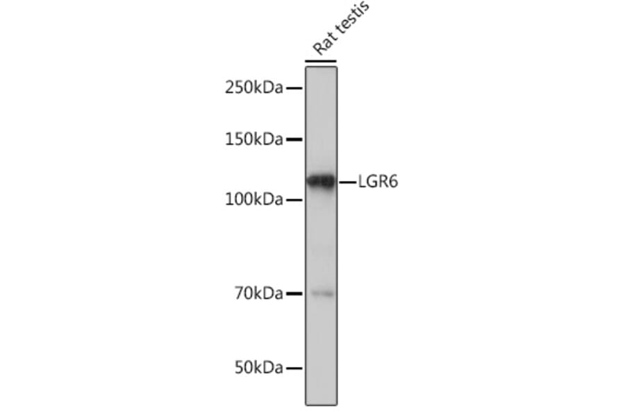 Western Blot - Anti-GPCR LGR6 Antibody [ARC1440] (A305907) - Antibodies.com