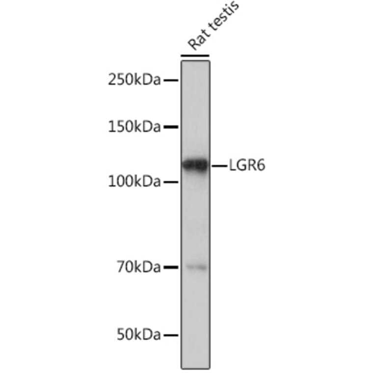 Western Blot - Anti-GPCR LGR6 Antibody [ARC1440] (A305907) - Antibodies.com