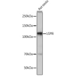 Western Blot - Anti-GPCR LGR6 Antibody [ARC1440] (A305907) - Antibodies.com