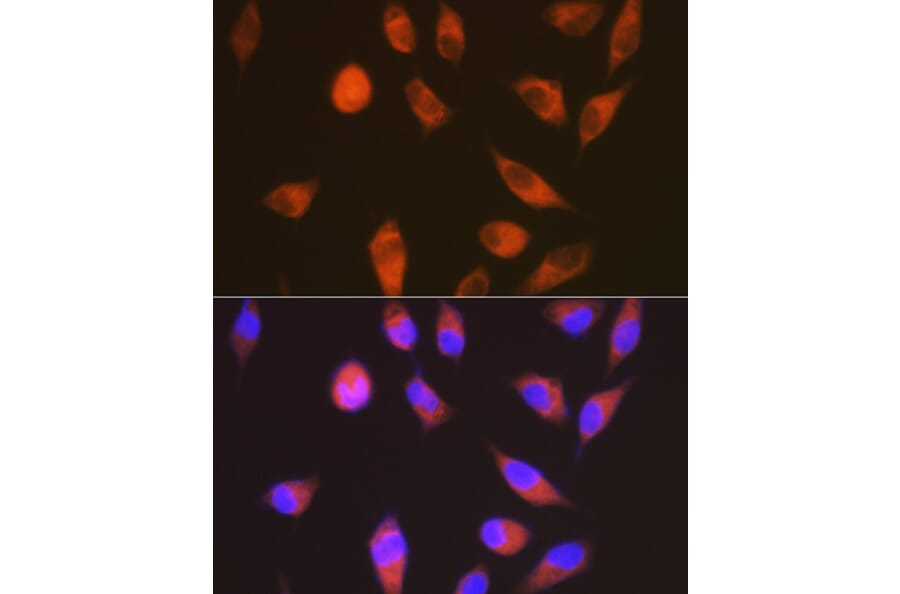 Immunofluorescence - Anti-GPCR LGR6 Antibody [ARC1440] (A305907) - Antibodies.com