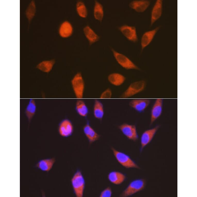 Immunofluorescence - Anti-GPCR LGR6 Antibody [ARC1440] (A305907) - Antibodies.com