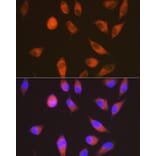 Immunofluorescence - Anti-GPCR LGR6 Antibody [ARC1440] (A305907) - Antibodies.com