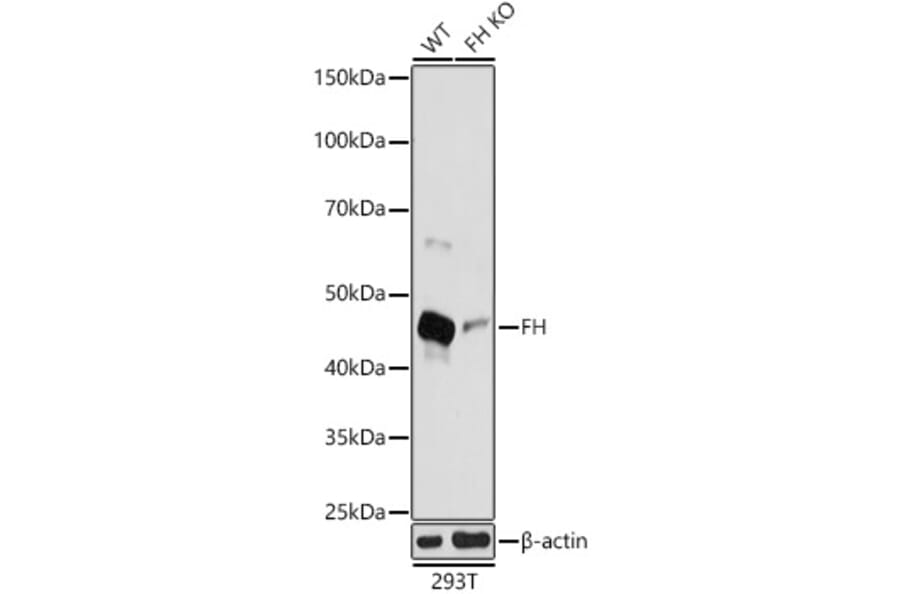 Western Blot - Anti-FH/Fumarase Antibody (A305909) - Antibodies.com