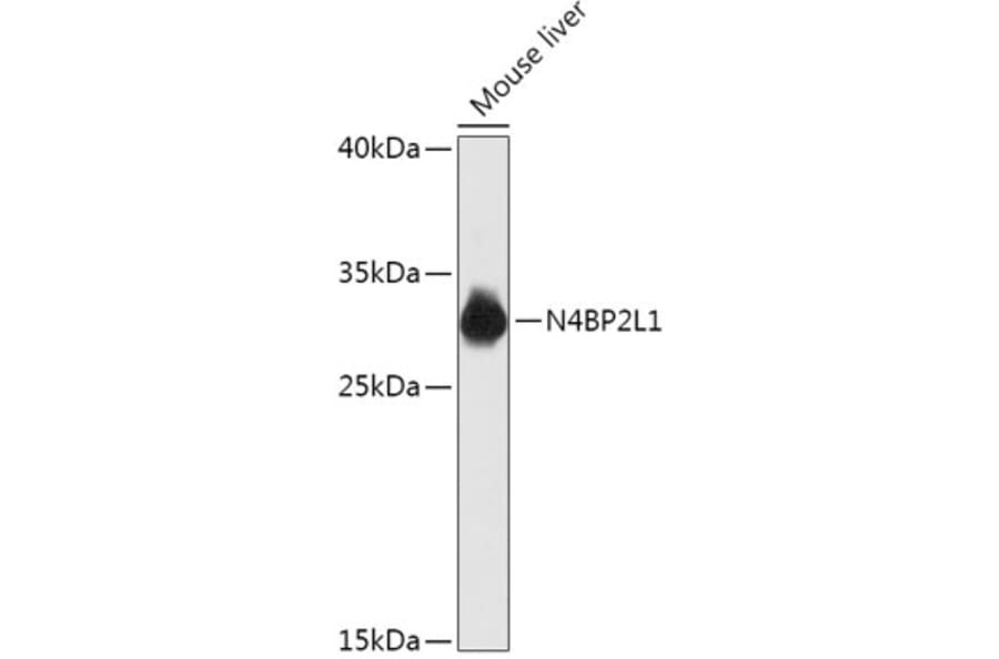 Western Blot - Anti-N42L1 Antibody (A305910) - Antibodies.com