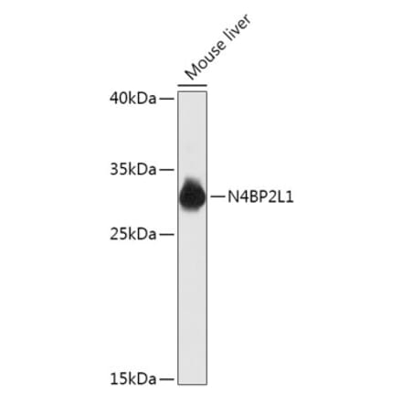 Western Blot - Anti-N42L1 Antibody (A305910) - Antibodies.com