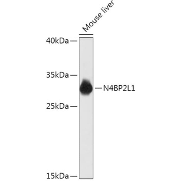 Western Blot - Anti-N42L1 Antibody (A305910) - Antibodies.com