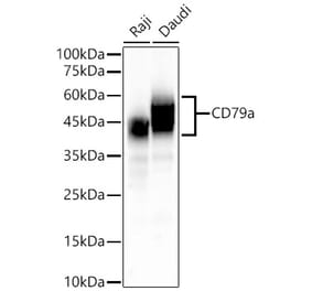 Western Blot - Anti-CD79a Antibody [ARC51145] (A305911) - Antibodies.com