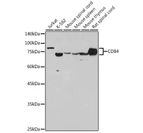 Western Blot - Anti-CD84 Antibody [ARC2570] (A305912) - Antibodies.com