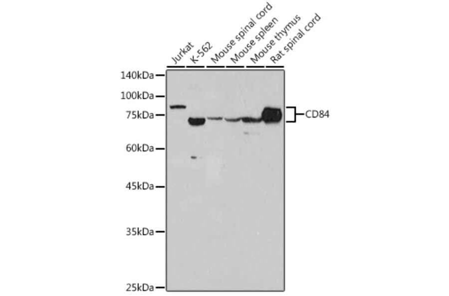 Western Blot - Anti-CD84 Antibody [ARC2570] (A305912) - Antibodies.com