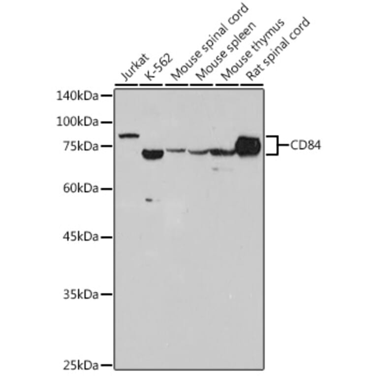 Western Blot - Anti-CD84 Antibody [ARC2570] (A305912) - Antibodies.com