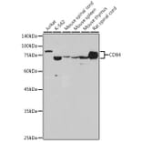 Western Blot - Anti-CD84 Antibody [ARC2570] (A305912) - Antibodies.com