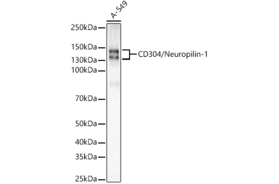 Western Blot - Anti-Neuropilin 1 Antibody [ARC55415] (A305913) - Antibodies.com