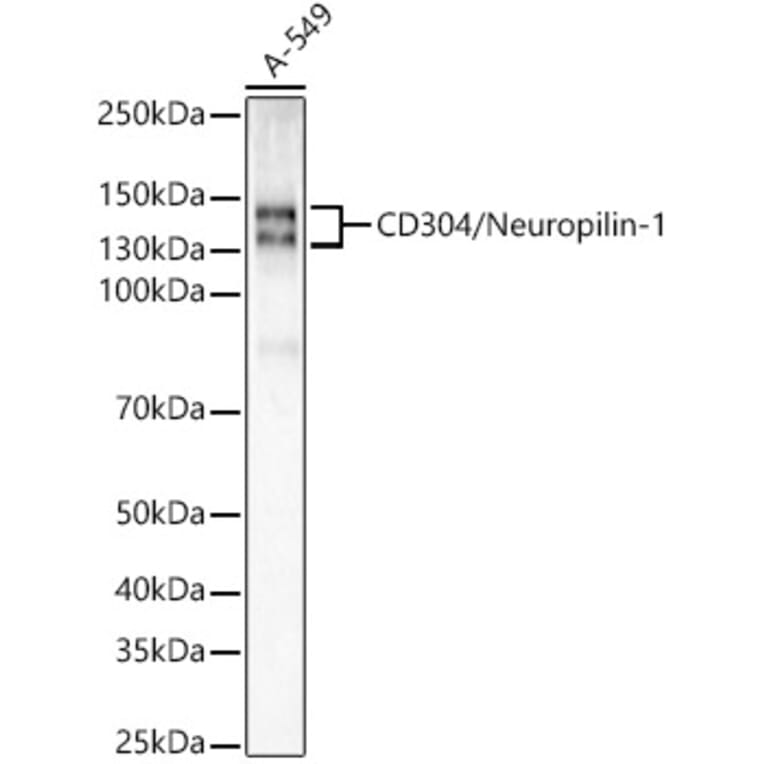 Western Blot - Anti-Neuropilin 1 Antibody [ARC55415] (A305913) - Antibodies.com