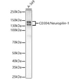 Western Blot - Anti-Neuropilin 1 Antibody [ARC55415] (A305913) - Antibodies.com