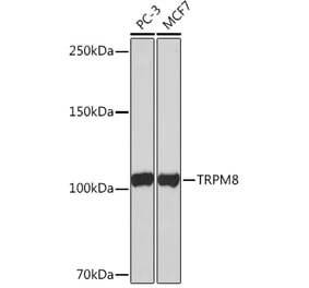 Western Blot - Anti-TRPM8 Antibody [ARC0947] (A305914) - Antibodies.com