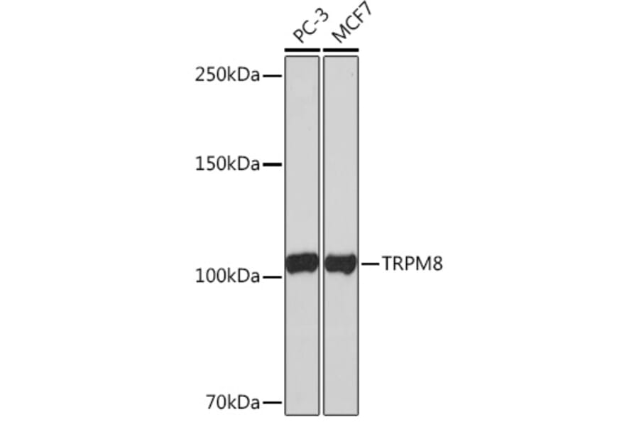 Western Blot - Anti-TRPM8 Antibody [ARC0947] (A305914) - Antibodies.com