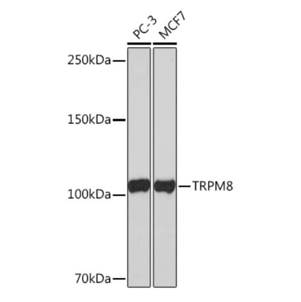 Western Blot - Anti-TRPM8 Antibody [ARC0947] (A305914) - Antibodies.com