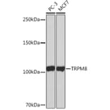 Western Blot - Anti-TRPM8 Antibody [ARC0947] (A305914) - Antibodies.com