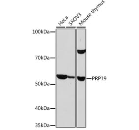 Western Blot - Anti-PRP19 Antibody [ARC1685] (A305915) - Antibodies.com