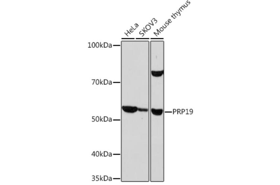 Western Blot - Anti-PRP19 Antibody [ARC1685] (A305915) - Antibodies.com
