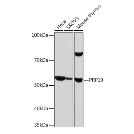 Western Blot - Anti-PRP19 Antibody [ARC1685] (A305915) - Antibodies.com
