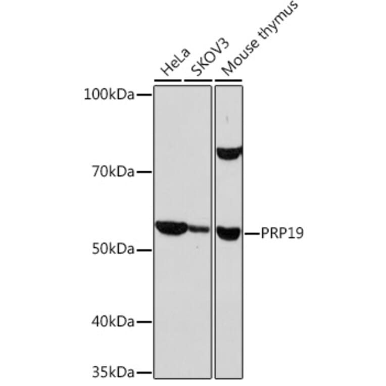 Western Blot - Anti-PRP19 Antibody [ARC1685] (A305915) - Antibodies.com