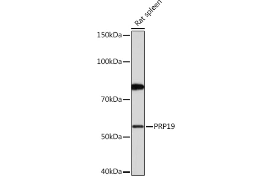 Western Blot - Anti-PRP19 Antibody [ARC1685] (A305915) - Antibodies.com