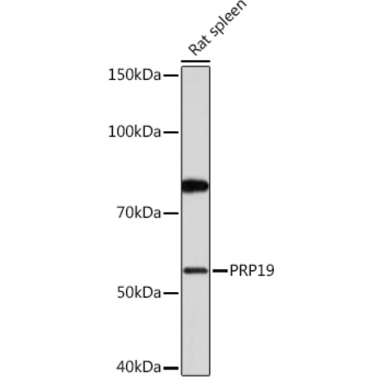 Western Blot - Anti-PRP19 Antibody [ARC1685] (A305915) - Antibodies.com
