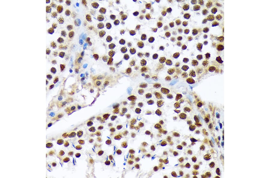 Immunohistochemistry - Anti-PRP19 Antibody [ARC1685] (A305915) - Antibodies.com