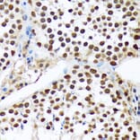 Immunohistochemistry - Anti-PRP19 Antibody [ARC1685] (A305915) - Antibodies.com