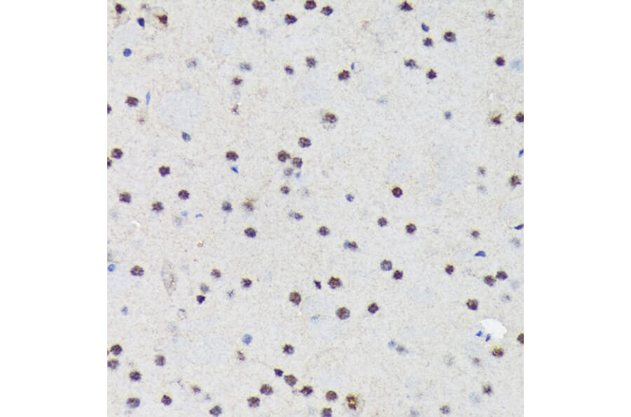 Immunohistochemistry - Anti-PRP19 Antibody [ARC1685] (A305915) - Antibodies.com