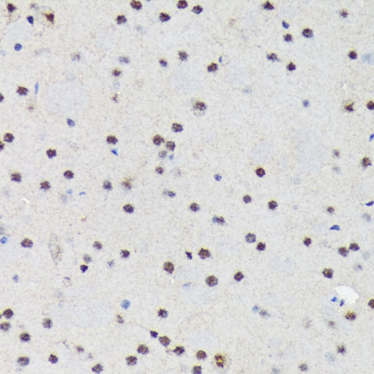 Immunohistochemistry - Anti-PRP19 Antibody [ARC1685] (A305915) - Antibodies.com
