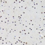 Immunohistochemistry - Anti-PRP19 Antibody [ARC1685] (A305915) - Antibodies.com